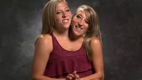 Conjoined Twins Abby And Brittany S Exciting News Oplaneta
