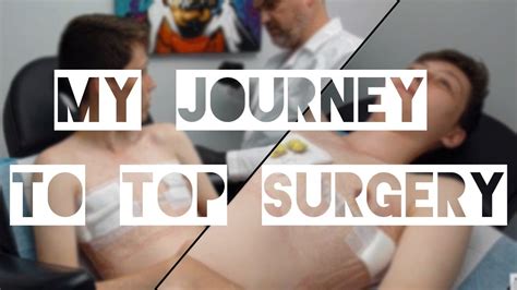 my journey to ftm top surgery including reveal dr garramone youtube