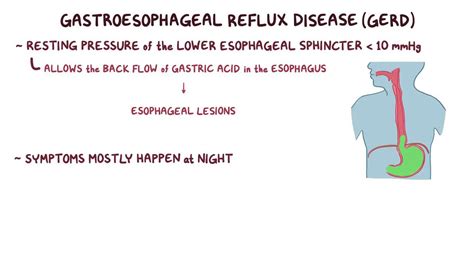 Gastroesophageal Reflux Disease GERD Clinical Osmosis