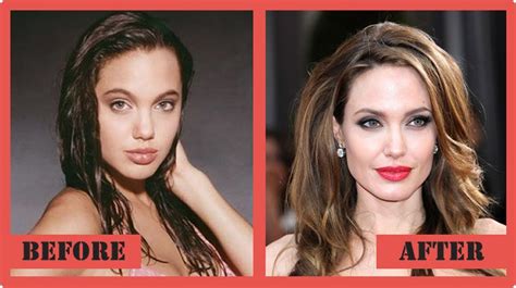 Angelina Jolie Celebrity Plastic Surgery Before And After Celebrity