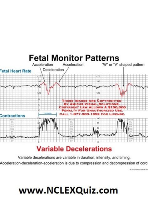Fetal Heartbeat Monitor Circuit Diagram
