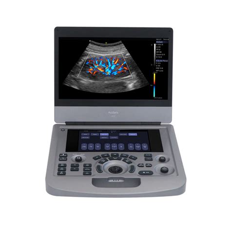 Medical Cardiac Echocardiography Echo Machine Portable Color Doppler