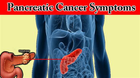 Asthenia The Common Signs Of Pancreatic Cancer That Appears In 86 Of Cases According To The