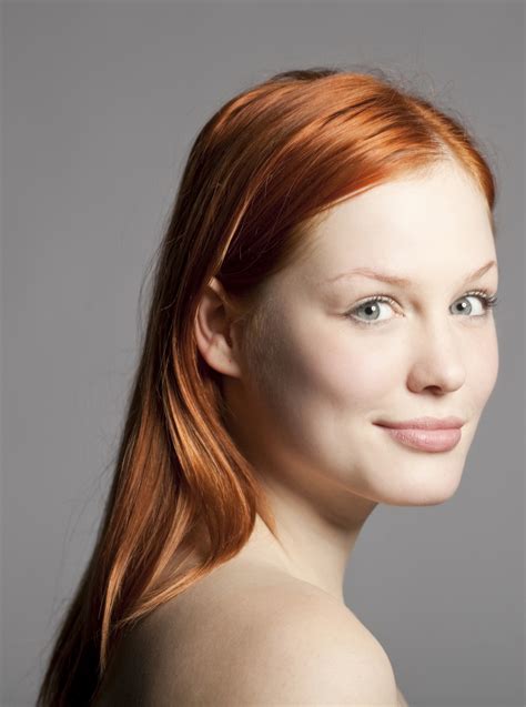 Pigment In Skin Of Redheads Could Make Them More Susceptible To Skin