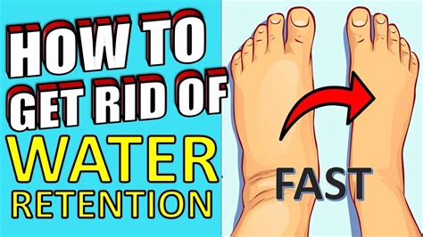 18 Powerful Home Remedies For Reducing Water Retention In The Body