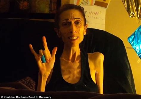 Anorexic Actress Rachael Farrokh Thanks The Public For Fundraising 200k Daily Mail Online