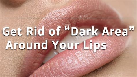Get Rid Of Dark Area Around Your Lips Natural Notes Beauty Youtube