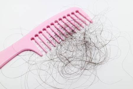 Hair loss is different than hair shedding. How to Stop Hair Falling Out While Combing and Shampooing ...