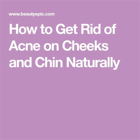 How To Get Rid Of Acne On Cheeks And Chin Naturally How To Get Rid Of