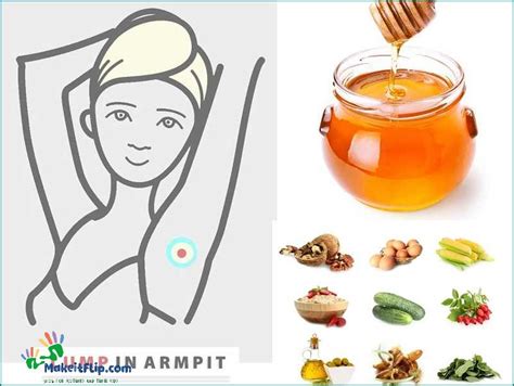 Effective Armpit Cyst Treatment Tips And Remedies Updated March 2024
