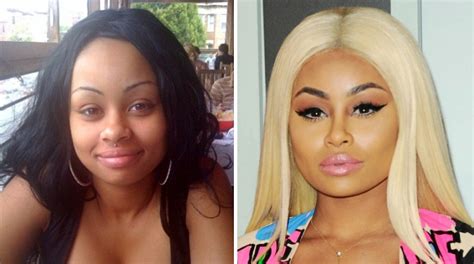 Blac Chyna Plastic Surgery Before And After Photos The Complete Story
