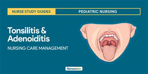 Tonsillitis And Adenoiditis Nursing Care Management Nursing Study