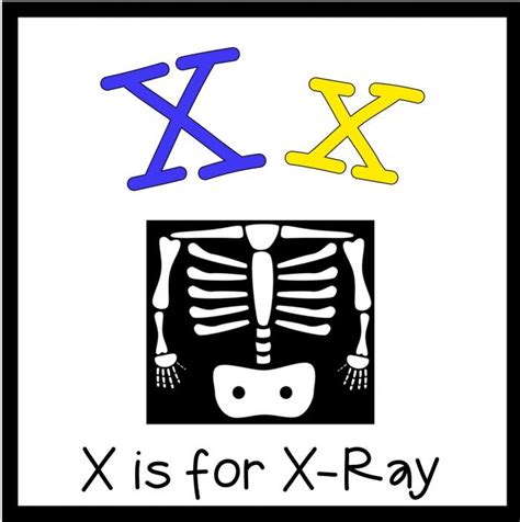 I am adept in example. 1000+ images about X Preschool Activities on Pinterest ...