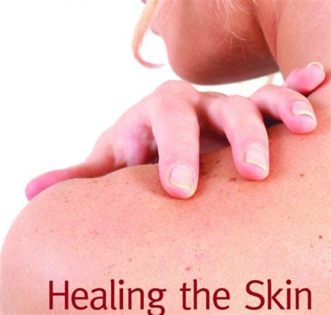 Healing Skin Conditions Acne Eczema Hives Psoriasis Etc Skin
