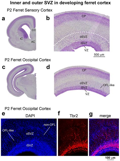 Inner And Outer Svz In The Developing Ferret Cortex Ac