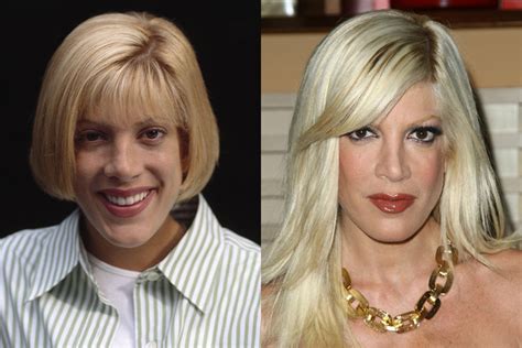 Tori Spelling Nose Job Plastic Surgery Before And After Photos