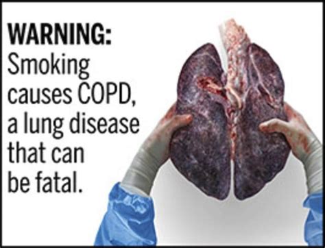 Pictures Of Damaged Lungs Caused By Smoking کامل مولیزی
