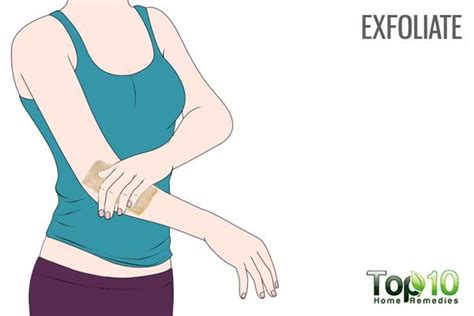 How To Treat Dry And Scaly Elbows With Home Remedies Top 10 Home Remedies