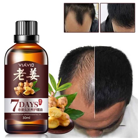 Hair Essential Oil Hair Care Oil Ginger Essence Hairdressing Hairs Mask Essential Oil Dry And