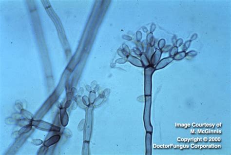 Fonsecaea Species Doctor Fungus