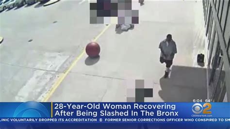 Woman Slashed In The Face By Man Who Asked For Directions In The Bronx