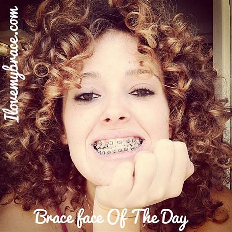The Beautiful Alfridabazinais Our Brace Face For Today G Flickr
