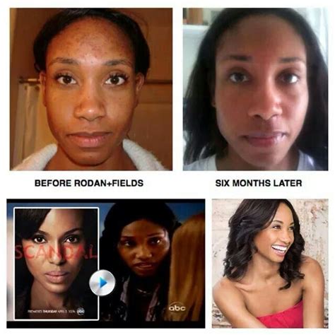 African American Skin Rodan And Fields Dermatologist Has You Covered