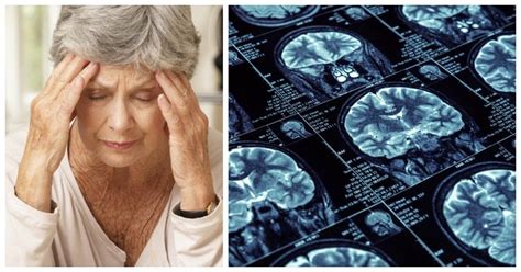 The 12 Early Warning Signs Of Dementia Every Woman Should Know | Signs ...