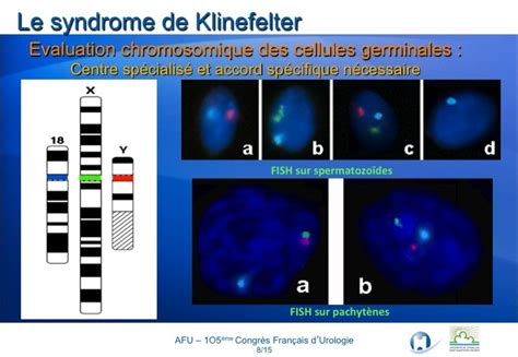 Urofrance Syndrome De Klinefelter De La Génétique à La Clinique