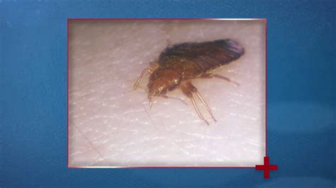 Bed Bugs And Disease Health Checks Youtube