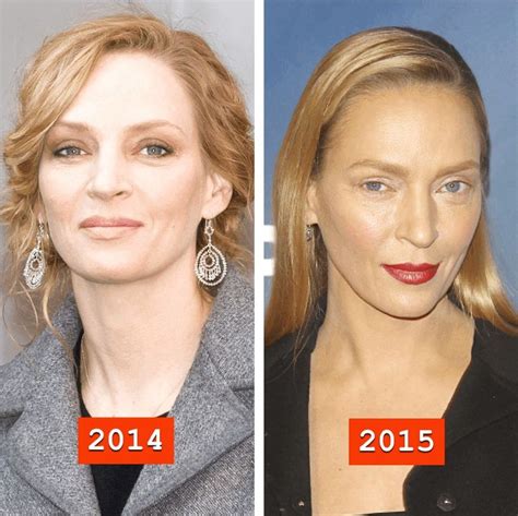 The actress looked like a completely different person while walking a red carpet on feb. Uma Thurman before and after plastic surgery 03 ...