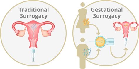 Surrogacy Genesis Fertility Centre British Columbia