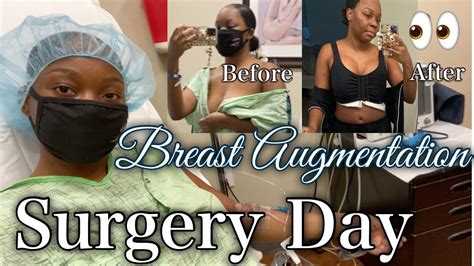 VLOG PREPPING FOR BREAST AUGMENTATION SURGERY DAY SUPPLY HAUL REAL RAW BEFORE AFTER