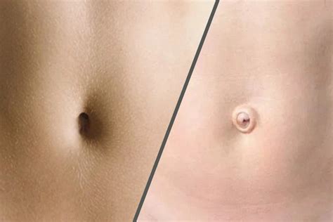 Innie Vs Outie Belly Button A Look Into The Differences Gosports
