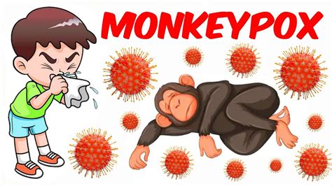 Monkeypox typically presents clinically with. Monkeypox! - YouTube