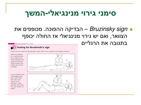 בדיקה נוירולוגית מורכבת משלבים שונים ולמעשה אינה בדיקה אחת אלא סדרת בדיקות הבוחנות מרכיבים שונים. PPT - בדיקה נוירולוגית מקיפה PowerPoint Presentation - ID ...