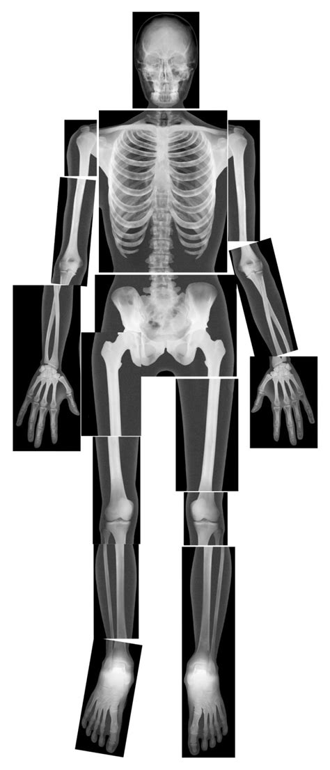 Roylco True To Life Human X Rays Set Of 18 Xray Art X Ray Human
