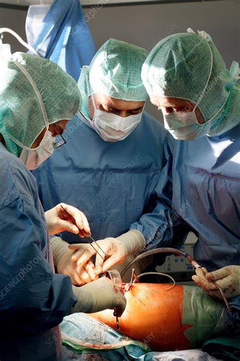 Hip Replacement Surgery Stock Image C008 7858 Science Photo Library