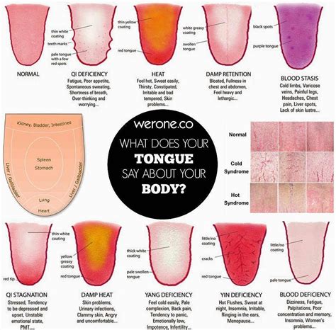 Healthy Tongue Tongue Health Mouth Health Ayurveda Natural Healing