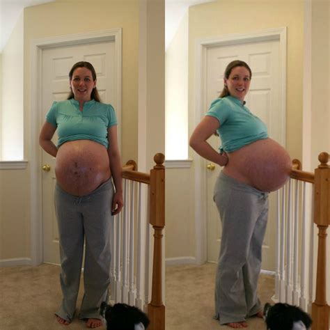 Triplet Pregnancy Pregnant With Triplets Belly Pregnant Belly Huge Weeks Pregnant Pretty
