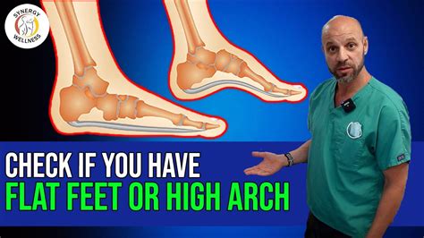 How To Check If You Have Flat Feet Or High Arch Youtube