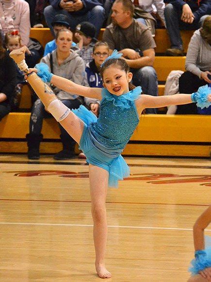 Utah Amputee Dancer Alissa Sizemore 8 Inspires After Losing Leg
