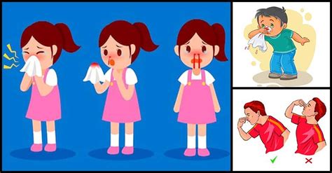 In most cases, a nosebleed or minor bleeding from the nose eventually stops on its own after a few. Nose Bleeding: Reasons Behind It And Its Home Remedies ...