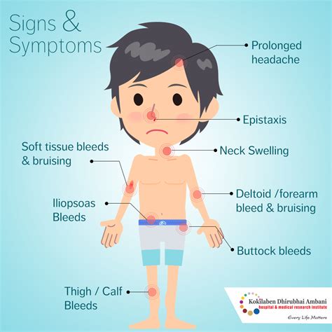 Simptomele hemofiliei severe sunt similare cu cele ale hemofiliei moderate. Symptoms of Hemophila - Health Tips from Kokilaben Hospital