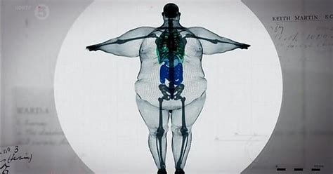 X Ray Of A 900 Pound Man Imgur