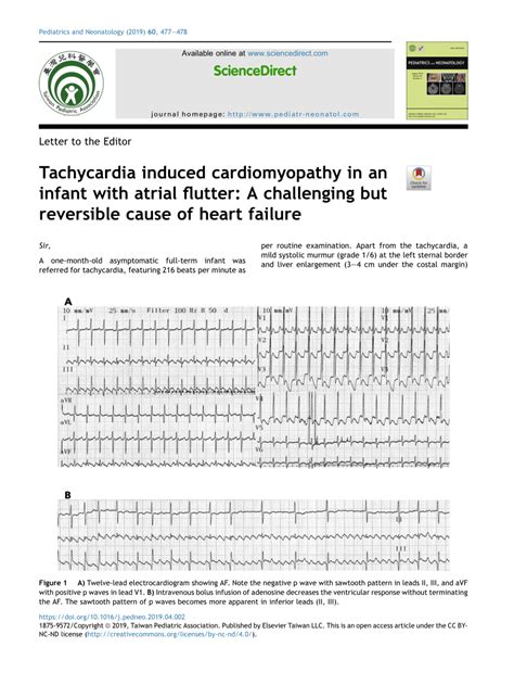 Pdf Tachycardia Induced Cardiomyopathy In An Infant With Atrial