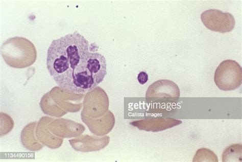 Light Micrograph Of A Normal Blood Smear High Res Stock Photo Getty