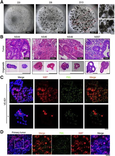 Characterization Of Organoids Developed From Crc Tumors And Treatment