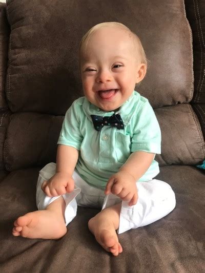 First Gerber Baby With Down Syndrome Is The Adorable Lucas Warren