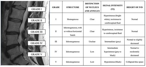 Stages Of Degenerative Disc Disease Neck